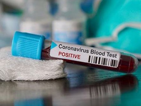 One more tests COVID-19 positive in Rajasthan