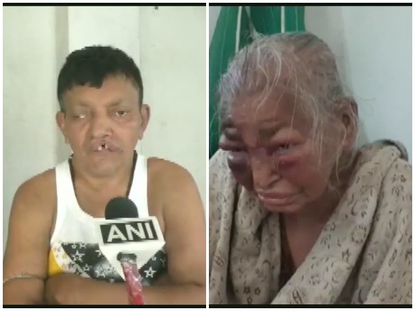 West Bengal: BJP worker's mother, who was allegedly attacked by TMC workers in February, dies