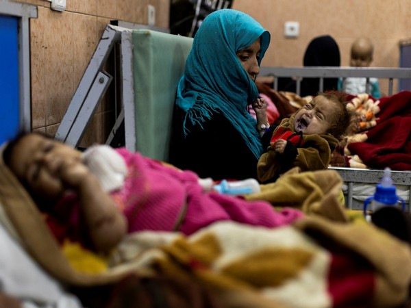 UN raises alarm over escalating malnutrition among women, children in Afghanistan